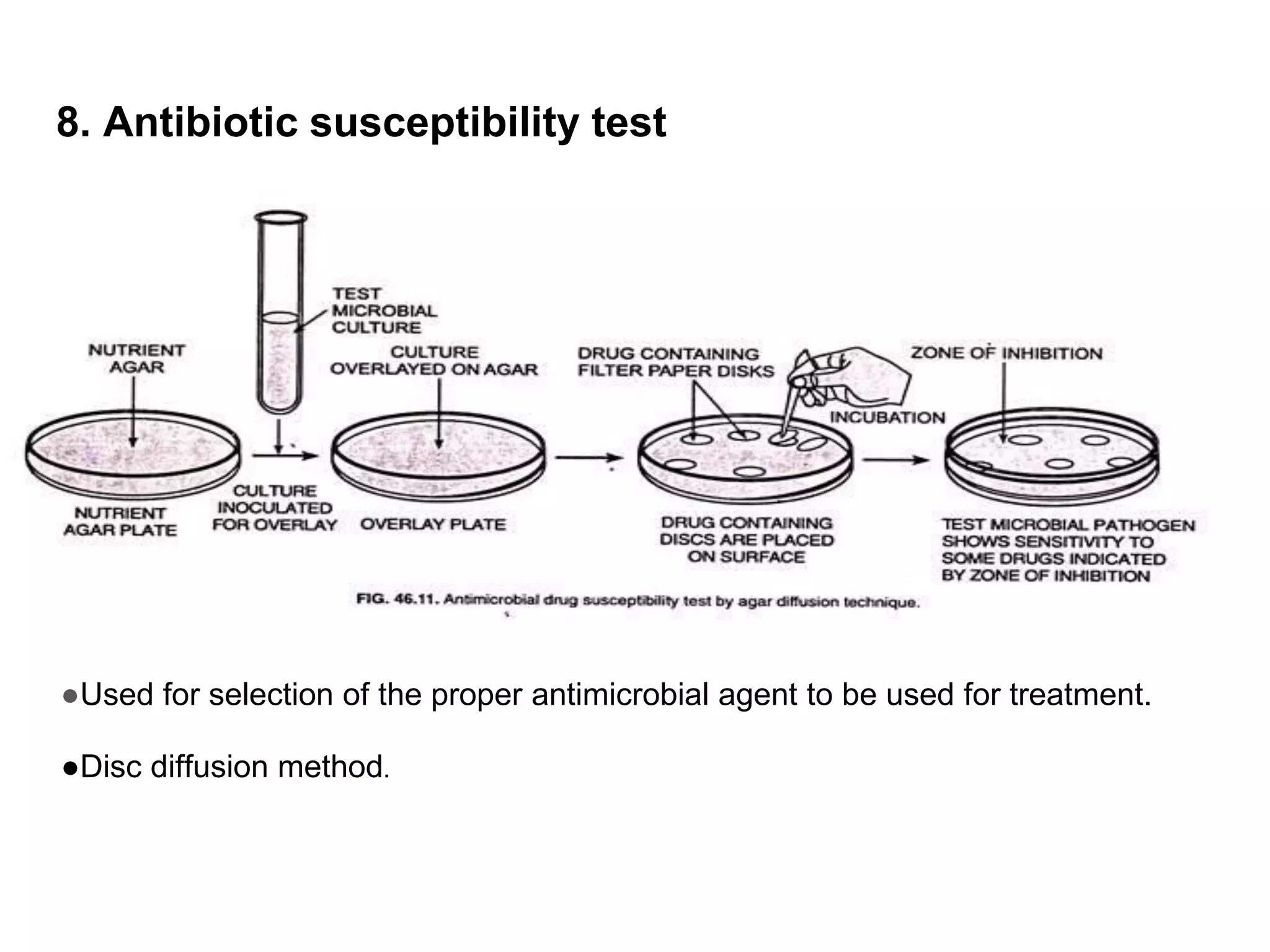 8. Antibiotic susceptibility test
●Used for selection of the proper antimicrobial agent to be used for treatment.
●Disc diffusion method.
 