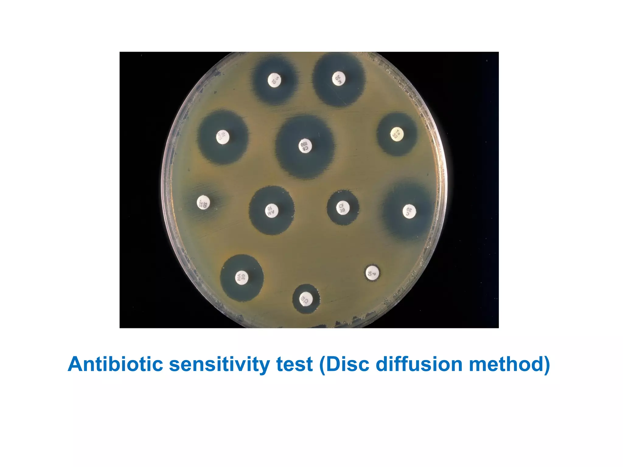 Antibiotic sensitivity test (Disc diffusion method)
 