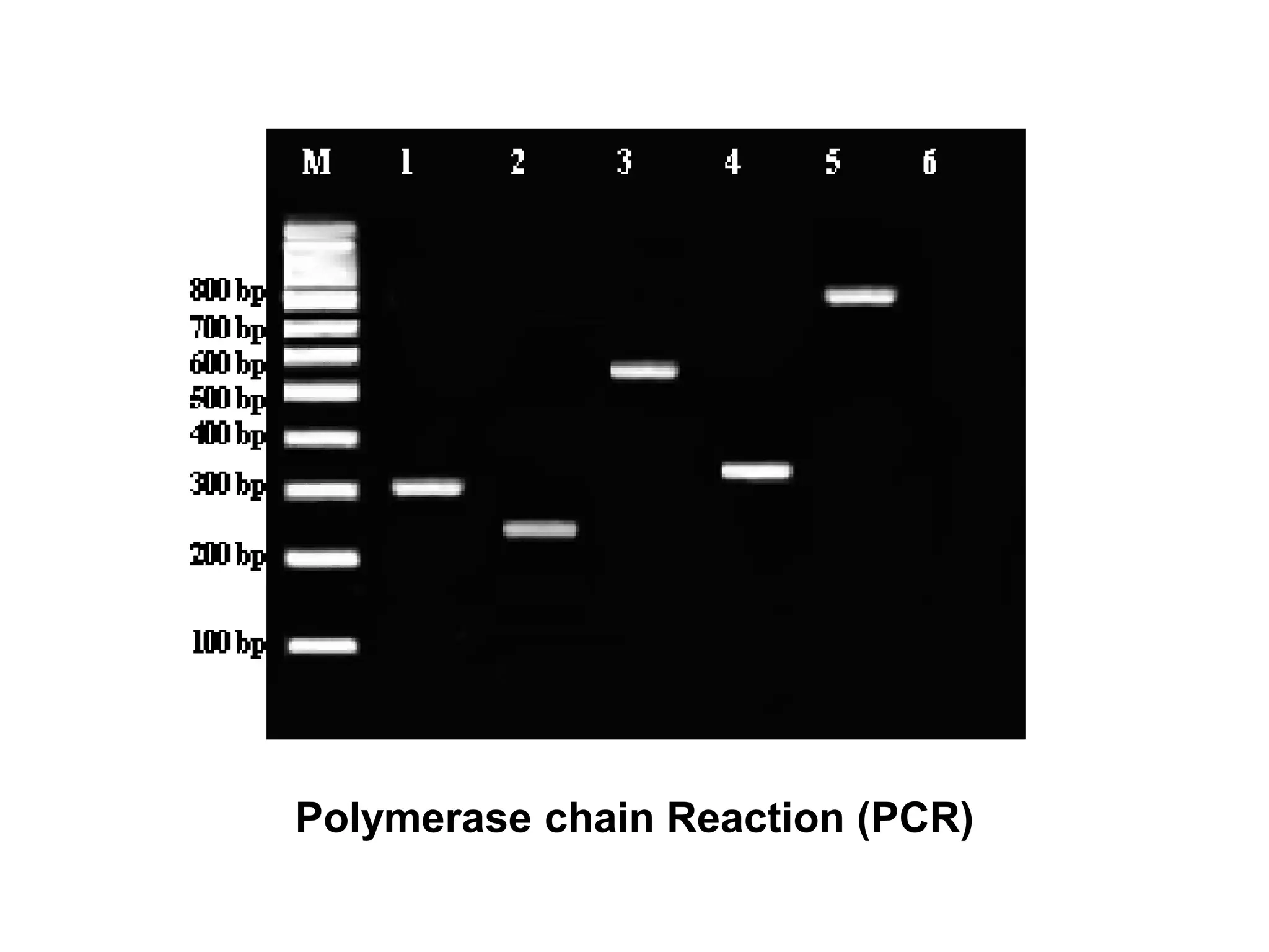 Polymerase chain Reaction (PCR)
 