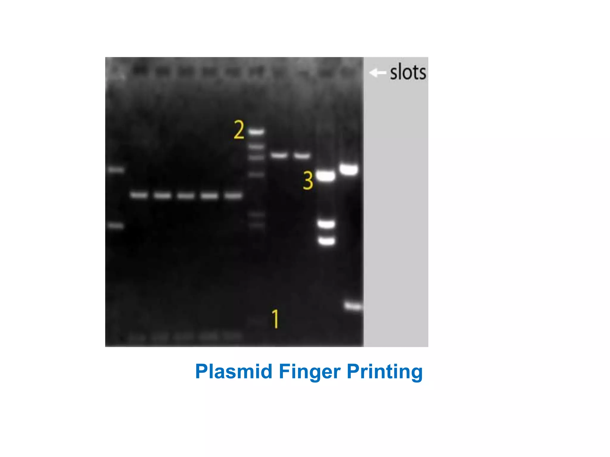 Plasmid Finger Printing
 