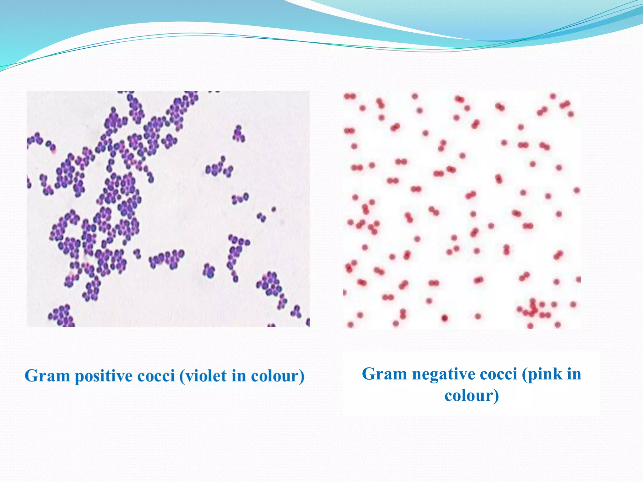 Gram negative cocci (pink in
colour)
 