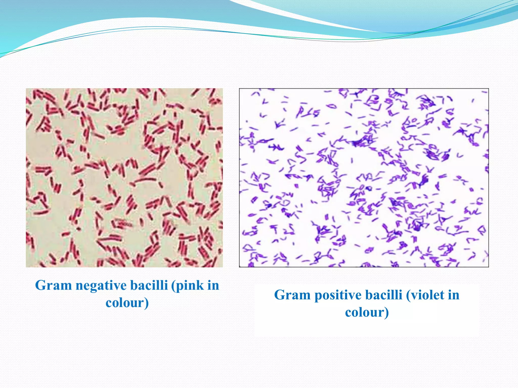 Gram positive bacilli (violet in
colour)
 