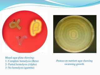 1
3
2
Proteus on nutrient agar showing
swarming growth
Blood agar plate showing:
1- Complete hemolysis (Beta)
2- Partial hemolysis (Alpha)
3- No hemolysis (gamma))
 