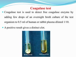 Coagulase test
 Coagulase test is used to detect free coagulase enzyme by
adding few drops of an overnight broth culture of the test
organism to 0.5 ml of human or rabbit plasma diluted 1/10.
 A positive result gives a distinct clot.
 