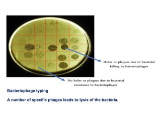 Bacteriophage typing
A number of specific phages leads to lysis of the bacteria.
 