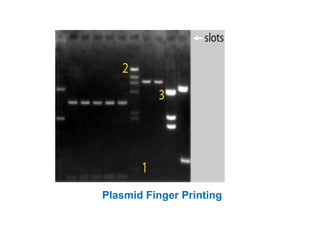 Plasmid Finger Printing
 