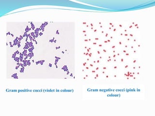 Gram negative cocci (pink in
colour)
 