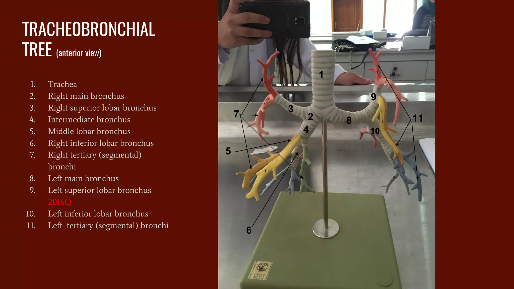 Trachea Model Labels Practical anatomy _ anatomy models labeled for medical students | PDF