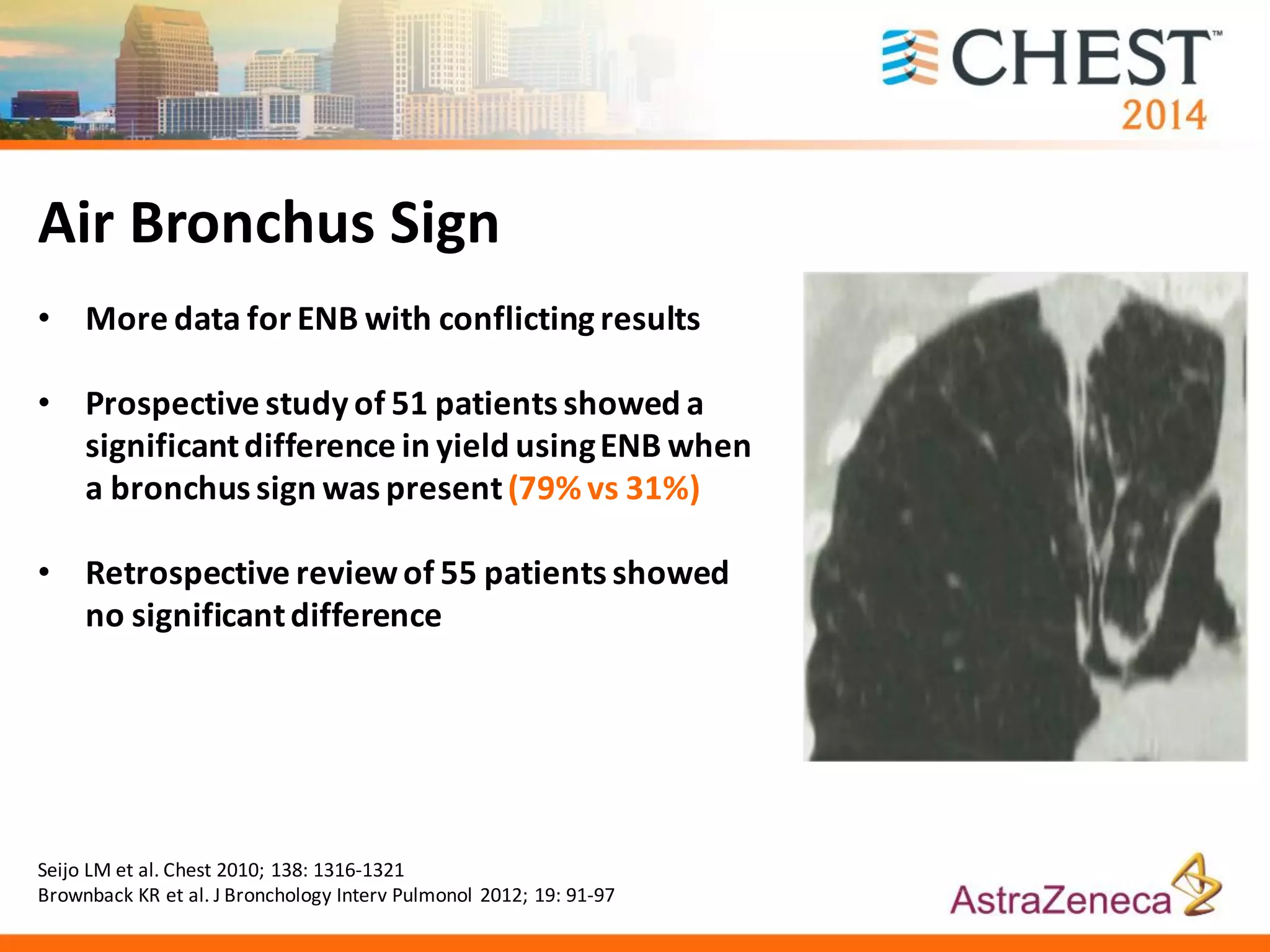 Air Bronchus Sign
• More data for ENB with conflicting results
• Prospective study of 51 patients showed a
significantdifference in yield usingENB when
a bronchus sign was present(79% vs 31%)
• Retrospective reviewof 55 patients showed
no significantdifference
Seijo LM et al. Chest 2010; 138: 1316-1321
Brownback KR et al. J Bronchology Interv Pulmonol 2012; 19: 91-97
 