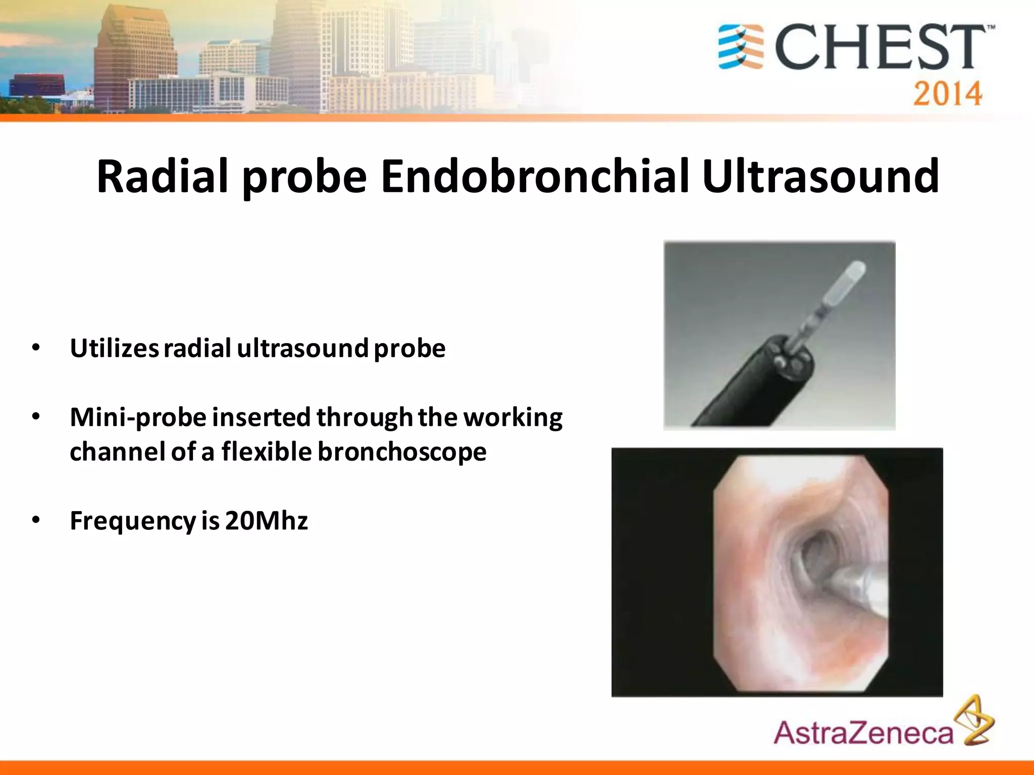 Radial probe Endobronchial Ultrasound
• Utilizesradial ultrasoundprobe
• Mini-probe inserted throughthe working
channel of a flexible bronchoscope
• Frequency is 20Mhz
 