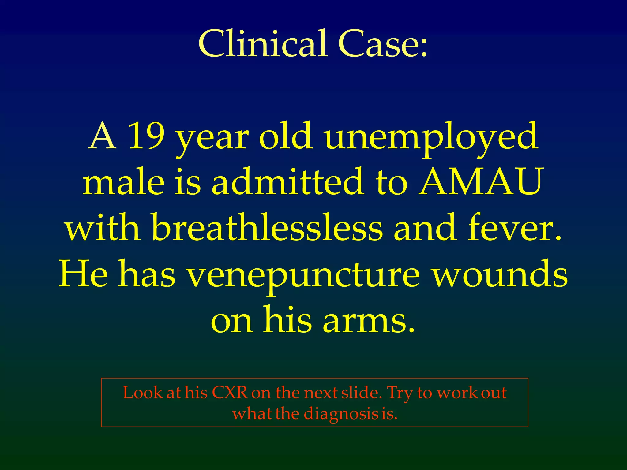 Clinical Case:
A 19 year old unemployed
male is admitted to AMAU
with breathlessless and fever.
He has venepuncture wounds
on his arms.
Look at his CXR on the next slide. Try to workout
what the diagnosisis.
 