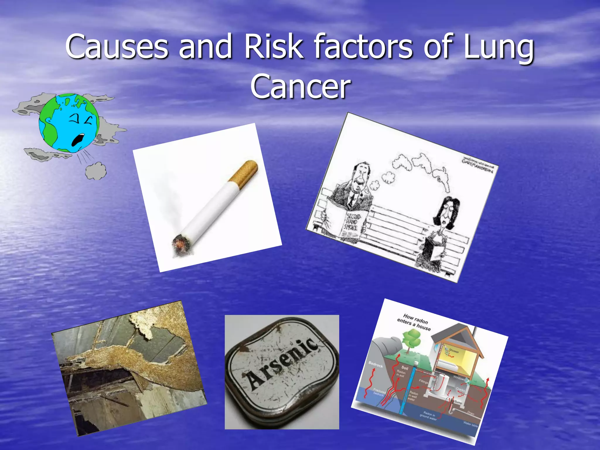 Causes and Risk factors of Lung
Cancer
 