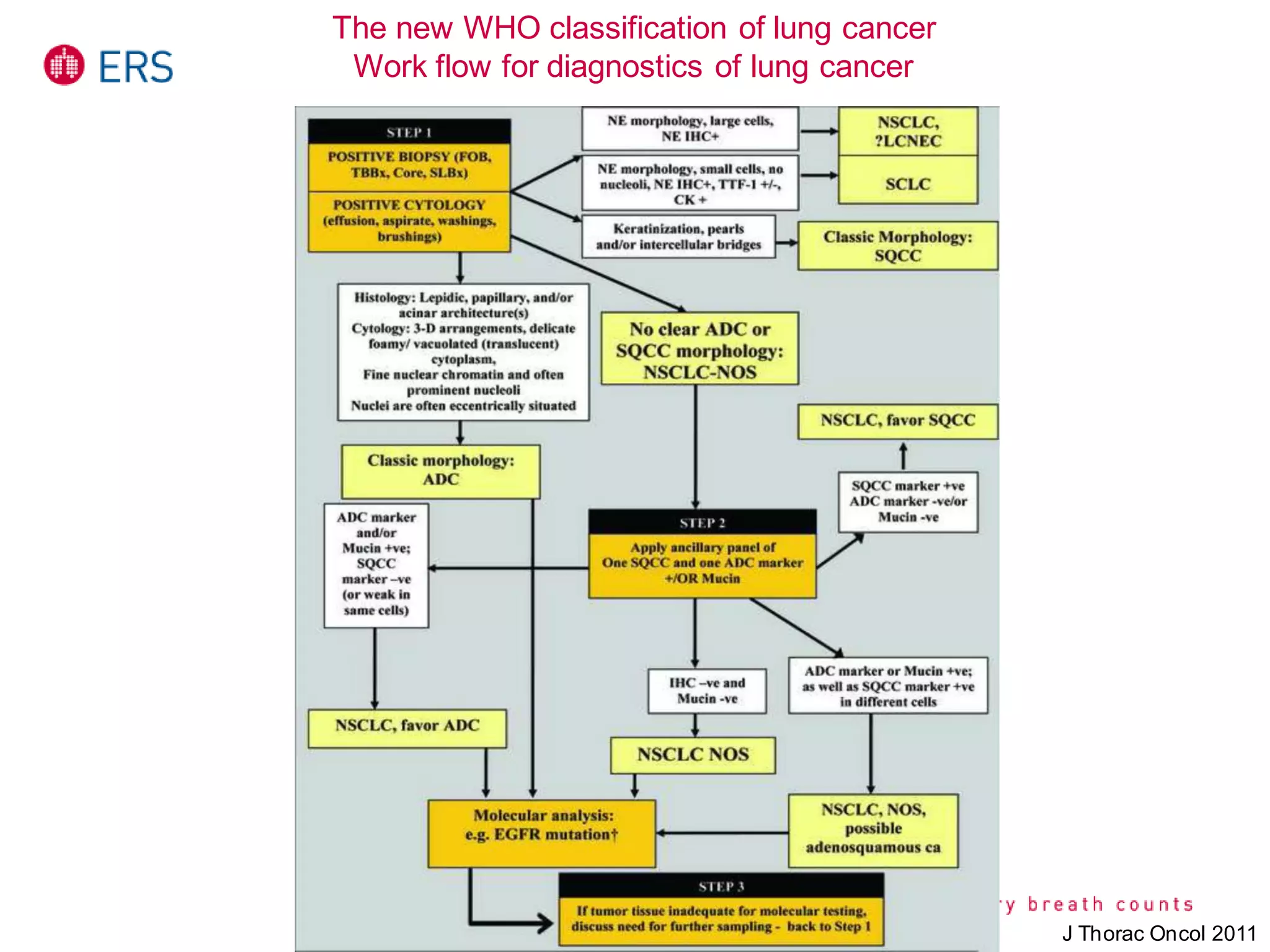 The new WHO classification of lung cancer
Work flow for diagnostics of lung cancer
J Thorac Oncol 2011
 