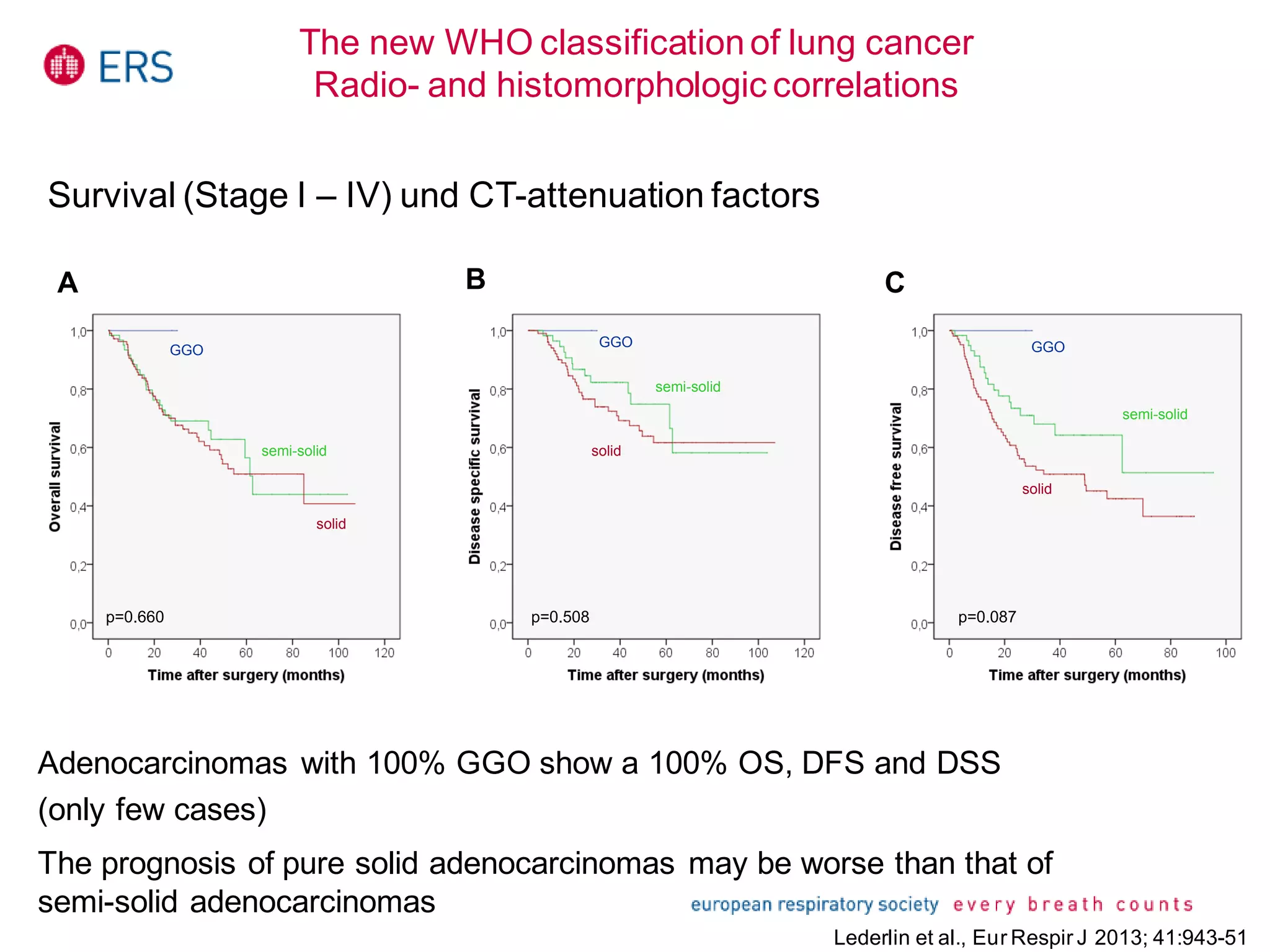 A
p=0.660
C
p=0.508
GGO
solid
p=0.087
B
semi-solid
GGO
solid
semi-solid
GGO
solid
semi-solid
Survival (Stage I – IV) und CT-attenuation factors
Adenocarcinomas with 100% GGO show a 100% OS, DFS and DSS
(only few cases)
The prognosis of pure solid adenocarcinomas may be worse than that of
semi-solid adenocarcinomas
The new WHO classificationof lung cancer
Radio- and histomorphologic correlations
Lederlin et al., Eur Respir J 2013; 41:943-51
 
