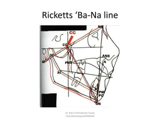 Ricketts Line Practical cephalometric tracing | PPTX