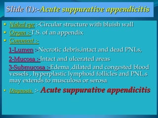 Slide (1):-Acute suppurative appendicitis
 Naked eye :-Circular structure with bluish wall
 Organ :-T.S. of an appendix
 Comment :-
  1-Lumen :-Necrotic debris,intact and dead PNLs,
  2-Mucosa :-Intact and ulcerated areas
  3-Submucosa :-Edema ,dilated and congested blood
  vessels , hyperplastic lymphoid follicles and PNL,s
  may extends to musculosa or serosa
 Diagnosis   :- Acute suppurative appendicitis
 