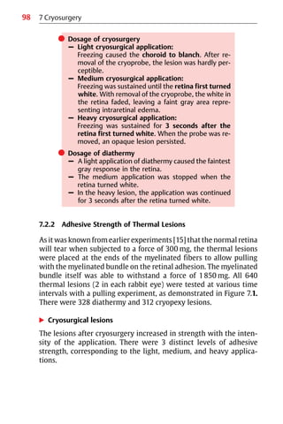 98
쎲 Dosage of cryosurgery
– Light cryosurgical application:
Freezing caused the choroid to blanch. After re-
moval of the cryoprobe, the lesion was hardly per-
ceptible.
– Medium cryosurgical application:
Freezing was sustained until the retina first turned
white. With removal of the cryoprobe, the white in
the retina faded, leaving a faint gray area repre-
senting intraretinal edema.
– Heavy cryosurgical application:
Freezing was sustained for 3 seconds after the
retina first turned white. When the probe was re-
moved, an opaque lesion persisted.
쎲 Dosage of diathermy
– A light application of diathermy caused the faintest
gray response in the retina.
– The medium application was stopped when the
retina turned white.
– In the heavy lesion, the application was continued
for 3 seconds after the retina turned white.
7.2.2 Adhesive Strength of Thermal Lesions
As it was known from earlier experiments [15] that the normal retina
will tear when subjected to a force of 300 mg, the thermal lesions
were placed at the ends of the myelinated fibers to allow pulling
with the myelinated bundle on the retinal adhesion. The myelinated
bundle itself was able to withstand a force of 1850 mg. All 640
thermal lesions (2 in each rabbit eye) were tested at various time
intervals with a pulling experiment, as demonstrated in Figure 7.1.
There were 328 diathermy and 312 cryopexy lesions.
왘 Cryosurgical lesions
The lesions after cryosurgery increased in strength with the inten-
sity of the application. There were 3 distinct levels of adhesive
strength, corresponding to the light, medium, and heavy applica-
tions.
7 Cryosurgery
 