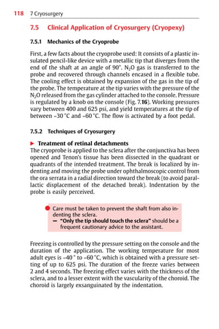 118
7.5 Clinical Application of Cryosurgery (Cryopexy)
7.5.1 Mechanics of the Cryoprobe
First, a few facts about the cryoprobe used: It consists of a plastic in-
sulated pencil-like device with a metallic tip that diverges from the
end of the shaft at an angle of 90°. N2O gas is transferred to the
probe and recovered through channels encased in a flexible tube.
The cooling effect is obtained by expansion of the gas in the tip of
the probe. The temperature at the tip varies with the pressure of the
N2O released from the gas cylinder attached to the console. Pressure
is regulated by a knob on the console (Fig. 7.16). Working pressures
vary between 400 and 625 psi, and yield temperatures at the tip of
between −30 °C and −60 °C. The flow is activated by a foot pedal.
7.5.2 Techniques of Cryosurgery
왘 Treatment of retinal detachments
The cryoprobe is applied to the sclera after the conjunctiva has been
opened and Tenon’s tissue has been dissected in the quadrant or
quadrants of the intended treatment. The break is localized by in-
denting and moving the probe under ophthalmoscopic control from
the ora serrata in a radial direction toward the break (to avoid paral-
lactic displacement of the detached break). Indentation by the
probe is easily perceived.
쎲 Care must be taken to prevent the shaft from also in-
denting the sclera.
– “Only the tip should touch the sclera” should be a
frequent cautionary advice to the assistant.
Freezing is controlled by the pressure setting on the console and the
duration of the application. The working temperature for most
adult eyes is −40 ° to −60 °C, which is obtained with a pressure set-
ting of up to 625 psi. The duration of the freeze varies between
2 and 4 seconds. The freezing effect varies with the thickness of the
sclera, and to a lesser extent with the vascularity of the choroid. The
choroid is largely exsanguinated by the indentation.
7 Cryosurgery
 