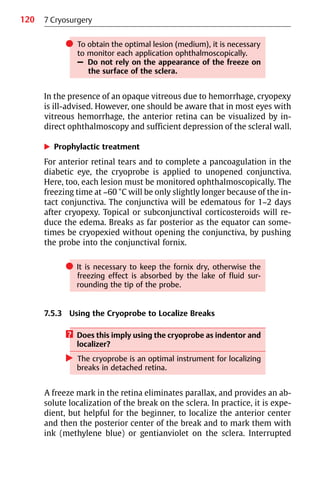 120
쎲 To obtain the optimal lesion (medium), it is necessary
to monitor each application ophthalmoscopically.
– Do not rely on the appearance of the freeze on
the surface of the sclera.
In the presence of an opaque vitreous due to hemorrhage, cryopexy
is ill-advised. However, one should be aware that in most eyes with
vitreous hemorrhage, the anterior retina can be visualized by in-
direct ophthalmoscopy and sufficient depression of the scleral wall.
왘 Prophylactic treatment
For anterior retinal tears and to complete a pancoagulation in the
diabetic eye, the cryoprobe is applied to unopened conjunctiva.
Here, too, each lesion must be monitored ophthalmoscopically. The
freezing time at −60 °C will be only slightly longer because of the in-
tact conjunctiva. The conjunctiva will be edematous for 1−2 days
after cryopexy. Topical or subconjunctival corticosteroids will re-
duce the edema. Breaks as far posterior as the equator can some-
times be cryopexied without opening the conjunctiva, by pushing
the probe into the conjunctival fornix.
쎲 It is necessary to keep the fornix dry, otherwise the
freezing effect is absorbed by the lake of fluid sur-
rounding the tip of the probe.
7.5.3 Using the Cryoprobe to Localize Breaks
? Does this imply using the cryoprobe as indentor and
localizer?
왘 The cryoprobe is an optimal instrument for localizing
breaks in detached retina.
A freeze mark in the retina eliminates parallax, and provides an ab-
solute localization of the break on the sclera. In practice, it is expe-
dient, but helpful for the beginner, to localize the anterior center
and then the posterior center of the break and to mark them with
ink (methylene blue) or gentianviolet on the sclera. Interrupted
7 Cryosurgery
 