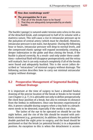 127
? How does nondrainage work?
왘 The prerequisites for it are:
1. That all of the breaks have to be found
2. That they are adequately tamponaded by an elastic
buckle.
The buckle (sponge) is sutured under tension onto sclera in the area
of the detached break, and compressed to half of its volume with a
mattress suture. This will cause a rise in intraocular pressure up to
the pulsation of central artery (which must be checked). However,
intraocular pressure is not static, but dynamic: During the following
hour or hours, intraocular pressure will drop to normal levels, and
the compressed elastic sponge will expand secondarily, creating a
deeper indentation in the globe and thus closing the break, if the
buckle is placed correctly. As a result—and only under these condi-
tions—subretinal fluid will disappear postoperatively and the retina
will reattach; but it can only reattach completely if all of the breaks
were found and adequately buckled. This is the secret (often de-
scribed as “miraculous”) of minimal surgery without drainage. The
following section describes how to carry out minimal extraocular
surgery without drainage.
8.2 Preoperative Management of Segmental Buckling
without Drainage
It is important at the time of surgery to have a detailed fundus
drawing of the precise location of the break or breaks to be treated
(see Chapter 2, p. 7). It is advisable not only to define preoperatively
the clock hour position of a break, but also to estimate its distance
from the limbus in millimeters. Once one becomes experienced at
this, it proves valuable during surgery when a tiny hole in a detach-
ment needs to be detected, especially if the media is not clear.
The lashes of the eye to be operated on should be cut the
night before, and the rim of the lids should be treated with anti-
biotic ointment (e.g., gentamicin). In addition, the patient should be
double patched the night prior to surgery, and the head should be
positioned so that the break (or potential breaks) is in a dependent
position. An exception to this is when the detachment is accom-
8.2 Preoperative Management
 