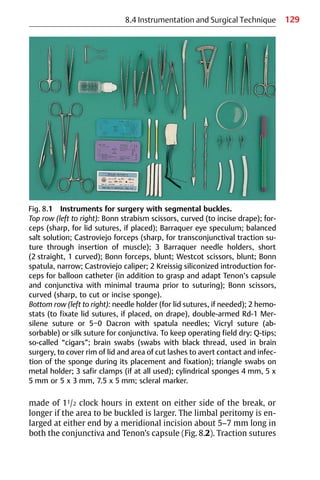 129
made of 11/2 clock hours in extent on either side of the break, or
longer if the area to be buckled is larger. The limbal peritomy is en-
larged at either end by a meridional incision about 5−7 mm long in
both the conjunctiva and Tenon’s capsule (Fig. 8.2). Traction sutures
Fig. 8.1 Instruments for surgery with segmental buckles.
Top row (left to right): Bonn strabism scissors, curved (to incise drape); for-
ceps (sharp, for lid sutures, if placed); Barraquer eye speculum; balanced
salt solution; Castroviejo forceps (sharp, for transconjunctival traction su-
ture through insertion of muscle); 3 Barraquer needle holders, short
(2 straight, 1 curved); Bonn forceps, blunt; Westcot scissors, blunt; Bonn
spatula, narrow; Castroviejo caliper; 2 Kreissig siliconized introduction for-
ceps for balloon catheter (in addition to grasp and adapt Tenon’s capsule
and conjunctiva with minimal trauma prior to suturing); Bonn scissors,
curved (sharp, to cut or incise sponge).
Bottom row (left to right): needle holder (for lid sutures, if needed); 2 hemo-
stats (to fixate lid sutures, if placed, on drape), double-armed Rd-1 Mer-
silene suture or 5−0 Dacron with spatula needles; Vicryl suture (ab-
sorbable) or silk suture for conjunctiva. To keep operating field dry: Q-tips;
so-called “cigars”; brain swabs (swabs with black thread, used in brain
surgery, to cover rim of lid and area of cut lashes to avert contact and infec-
tion of the sponge during its placement and fixation); triangle swabs on
metal holder; 3 safir clamps (if at all used); cylindrical sponges 4 mm, 5 x
5 mm or 5 x 3 mm, 7.5 x 5 mm; scleral marker.
8.4 Instrumentation and Surgical Technique
 