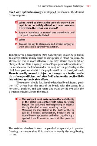 131
tored with ophthalmoscopy and stopped the moment the desired
freeze appears.
? What should be done at the time of surgery if the
pupil is not as widely dilated as it was preopera-
tively when the retina was studied?
왘 Surgery should not be started; one should wait until
the pupil is optimally dilated.
? Why?
왘 Because the key to atraumatic and precise surgery of
short duration is optimal visualization.
Topical sterile phenylephrine (Neo-Synephrine) 5% can help, but in
an elderly patient it may cause an abrupt rise in blood pressure. An
alternative that is more effective is to have sterile cocaine 5% or
phenylephrine 5% in a syringe with a 30-gauge needle and to insert
the needle near the limbus under the conjunctiva, preferably at the
clock hour position at which the pupil should be maximally dilated.
There is usually no need to inject, as the mydriatic in the needle
tip is already sufficient, and after 5−10 minutes the pupil will di-
late without systemic side effects.
The surgeon should localize the detached break from a posi-
tion 180° across from the area of the break, with the cornea in a
horizontal position, and can rotate and stabilize the eye with the
2 traction sutures across the break.
쎲 – The assistant must make certain that only the tip
of the probe is in contact with sclera for every
freeze. This will avoid misinterpreting an indenta-
tion by the shaft as one caused by the tip.
– Mistaking the indentation of the shaft for the tip
can be a serious complication, because the tip
would be more posterior, and when cryotherapy is
applied it could cause a freeze at the posterior
pole.
The assistant also has to keep the parabulbar space dry, to prevent
freezing the surrounding fluid and consequently the neighboring
tissues.
8.4 Instrumentation and Surgical Technique
 