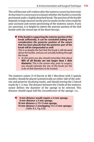 133
This will become self-evident after the mattress suture has been tied.
Atthattimeitisnecessarytoevaluatewhetherthebuckleiscorrectly
positioned under a highly detached break. The position of the buckle
depends in large measure on the precise marks on the sclera made by
your assistant and correct positioning of the mattress suture. If you
are uncertain, it is helpful to indent the anterior portion of the tied
buckle with the closed tips of the blunt forceps.
쎲 If the buckle is supporting the anterior portion of the
break sufficiently, it can be concluded (taking into
consideration the posterior position of the suture
that has been placed) that the posterior part of the
break will be tamponaded as well.
This is so despite the fact that the break is still elevated
above the buckle, and you are actually looking through
the break.
– At this point you also should remember that about
90% of all breaks are not larger than 1 disk
diameter. This is the reason why, prior to surgery,
you should estimate the size of the break (on the
scale of disk diameter) to be treated.
The mattress suture (5−0 Dacron or Rd-1 Mersilene with 2 spatula
needles) should be placed symmetrically on either side of the ante-
rior and posterior localizing marks, and should overlap the 2 lateral
marks by 1−2 mm. The distance between the 2 limbs of the mattress
suture defines the diameter of the sponge to be selected. This
distance should equal half the circumference of the sponge—i.e.,
쎲 6 mm distance would require a 4 mm sponge,
8 mm distance a 5 mm sponge,
10 mm distance a 7.5×5 mm sponge,
14 mm distance 2 overlapping 7.5 x 5 mm sponges
(Table 8.1, Fig. 8.3).
8.4 Instrumentation and Surgical Technique
 