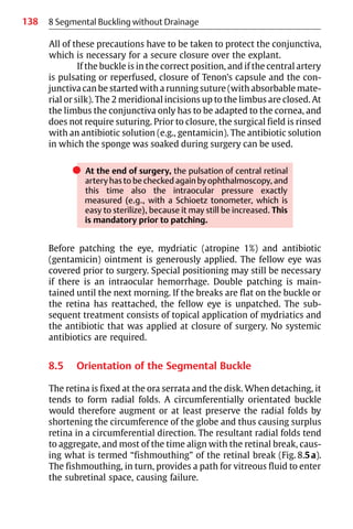 138
All of these precautions have to be taken to protect the conjunctiva,
which is necessary for a secure closure over the explant.
If the buckle is in the correct position, and if the central artery
is pulsating or reperfused, closure of Tenon’s capsule and the con-
junctiva can be started with a running suture (with absorbable mate-
rial or silk). The 2 meridional incisions up to the limbus are closed. At
the limbus the conjunctiva only has to be adapted to the cornea, and
does not require suturing. Prior to closure, the surgical field is rinsed
with an antibiotic solution (e.g., gentamicin). The antibiotic solution
in which the sponge was soaked during surgery can be used.
쎲 At the end of surgery, the pulsation of central retinal
artery has to be checked again by ophthalmoscopy, and
this time also the intraocular pressure exactly
measured (e.g., with a Schioetz tonometer, which is
easy to sterilize), because it may still be increased. This
is mandatory prior to patching.
Before patching the eye, mydriatic (atropine 1%) and antibiotic
(gentamicin) ointment is generously applied. The fellow eye was
covered prior to surgery. Special positioning may still be necessary
if there is an intraocular hemorrhage. Double patching is main-
tained until the next morning. If the breaks are flat on the buckle or
the retina has reattached, the fellow eye is unpatched. The sub-
sequent treatment consists of topical application of mydriatics and
the antibiotic that was applied at closure of surgery. No systemic
antibiotics are required.
8.5 Orientation of the Segmental Buckle
The retina is fixed at the ora serrata and the disk. When detaching, it
tends to form radial folds. A circumferentially orientated buckle
would therefore augment or at least preserve the radial folds by
shortening the circumference of the globe and thus causing surplus
retina in a circumferential direction. The resultant radial folds tend
to aggregate, and most of the time align with the retinal break, caus-
ing what is termed “fishmouthing” of the retinal break (Fig. 8.5a).
The fishmouthing, in turn, provides a path for vitreous fluid to enter
the subretinal space, causing failure.
8 Segmental Buckling without Drainage
 