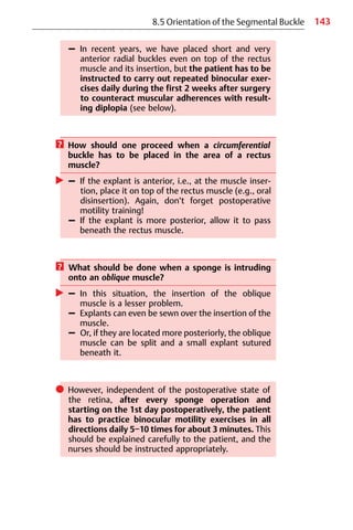 143
– In recent years, we have placed short and very
anterior radial buckles even on top of the rectus
muscle and its insertion, but the patient has to be
instructed to carry out repeated binocular exer-
cises daily during the first 2 weeks after surgery
to counteract muscular adherences with result-
ing diplopia (see below).
? How should one proceed when a circumferential
buckle has to be placed in the area of a rectus
muscle?
왘 – If the explant is anterior, i.e., at the muscle inser-
tion, place it on top of the rectus muscle (e.g., oral
disinsertion). Again, don’t forget postoperative
motility training!
– If the explant is more posterior, allow it to pass
beneath the rectus muscle.
? What should be done when a sponge is intruding
onto an oblique muscle?
왘 – In this situation, the insertion of the oblique
muscle is a lesser problem.
– Explants can even be sewn over the insertion of the
muscle.
– Or, if they are located more posteriorly, the oblique
muscle can be split and a small explant sutured
beneath it.
쎲 However, independent of the postoperative state of
the retina, after every sponge operation and
starting on the 1st day postoperatively, the patient
has to practice binocular motility exercises in all
directions daily 5−10 times for about 3 minutes. This
should be explained carefully to the patient, and the
nurses should be instructed appropriately.
8.5 Orientation of the Segmental Buckle
 