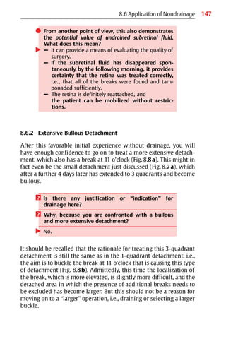 147
8.6 Application of Nondrainage
쎲 From another point of view, this also demonstrates
the potential value of undrained subretinal fluid.
What does this mean?
왘 – It can provide a means of evaluating the quality of
surgery.
– If the subretinal fluid has disappeared spon-
taneously by the following morning, it provides
certainty that the retina was treated correctly,
i.e., that all of the breaks were found and tam-
ponaded sufficiently.
– The retina is definitely reattached, and
the patient can be mobilized without restric-
tions.
8.6.2 Extensive Bullous Detachment
After this favorable initial experience without drainage, you will
have enough confidence to go on to treat a more extensive detach-
ment, which also has a break at 11 o’clock (Fig. 8.8a). This might in
fact even be the small detachment just discussed (Fig. 8.7a), which
after a further 4 days later has extended to 3 quadrants and become
bullous.
? Is there any justification or “indication” for
drainage here?
? Why, because you are confronted with a bullous
and more extensive detachment?
왘 No.
It should be recalled that the rationale for treating this 3-quadrant
detachment is still the same as in the 1-quadrant detachment, i.e.,
the aim is to buckle the break at 11 o’clock that is causing this type
of detachment (Fig. 8.8b). Admittedly, this time the localization of
the break, which is more elevated, is slightly more difficult, and the
detached area in which the presence of additional breaks needs to
be excluded has become larger. But this should not be a reason for
moving on to a “larger” operation, i.e., draining or selecting a larger
buckle.
 