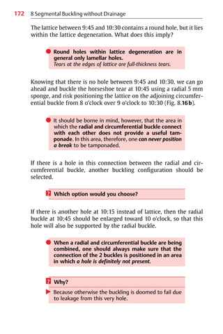 172 8 Segmental Buckling without Drainage
The lattice between 9:45 and 10:30 contains a round hole, but it lies
within the lattice degeneration. What does this imply?
쎲 Round holes within lattice degeneration are in
general only lamellar holes.
Tears at the edges of lattice are full-thickness tears.
Knowing that there is no hole between 9:45 and 10:30, we can go
ahead and buckle the horseshoe tear at 10:45 using a radial 5 mm
sponge, and risk positioning the lattice on the adjoining circumfer-
ential buckle from 8 o’clock over 9 o’clock to 10:30 (Fig. 8.16b).
쎲 It should be borne in mind, however, that the area in
which the radial and circumferential buckle connect
with each other does not provide a useful tam-
ponade. In this area, therefore, one can never position
a break to be tamponaded.
If there is a hole in this connection between the radial and cir-
cumferential buckle, another buckling configuration should be
selected.
? Which option would you choose?
If there is another hole at 10:15 instead of lattice, then the radial
buckle at 10:45 should be enlarged toward 10 o’clock, so that this
hole will also be supported by the radial buckle.
쎲 When a radial and circumferential buckle are being
combined, one should always make sure that the
connection of the 2 buckles is positioned in an area
in which a hole is definitely not present.
? Why?
왘 Because otherwise the buckling is doomed to fail due
to leakage from this very hole.
 
