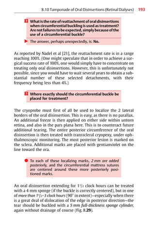 193
? What is the rate of reattachment of oral disinsertions
when circumferential buckling is used as treatment?
Arenotfailurestobeexpected,simplybecauseofthe
use of a circumferential buckle?
왘 The answer, perhaps unexpectedly, is: No.
As reported by Nadel et al [21], the reattachment rate is in a range
reaching 100%. (One might speculate that in order to achieve a sur-
gical success rate of 100%, one would simply have to concentrate on
treating only oral disinsertions. However, this is unfortunately not
possible, since you would have to wait several years to obtain a sub-
stantial number of these selected detachments, with their
frequency being less than 4%.)
? Where exactly should the circumferential buckle be
placed for treatment?
The cryoprobe must first of all be used to localize the 2 lateral
borders of the oral disinsertion. This is easy, as there is no parallax.
An additional freeze is then applied on either side within untorn
retina, and also in the pars plana here. This is to counteract future
additional tearing. The entire posterior circumference of the oral
disinsertion is then treated with transscleral cryopexy, under oph-
thalmoscopic monitoring. The most posterior lesion is marked on
the sclera. Additional marks are placed with gentianviolet on the
line toward the ora.
쎲 To each of these localizing marks, 2 mm are added
posteriorly, and the circumferential mattress sutures
are centered around these more posteriorly posi-
tioned marks.
An oral disinsertion extending for 11/2 clock hours can be treated
with a 4 mm sponge (if the buckle is correctly centered), but in one
of more than 11/2−3 clock hours (90° in extent)—especially when there
is a great deal of dislocation of the edge in posterior direction—the
tear should be buckled with a 5 mm full-thickness sponge cylinder,
again without drainage of course (Fig. 8.29).
8.10 Tamponade of Oral Disinsertions (Retinal Dialyses)
 