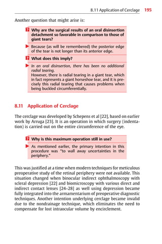 195
8.11 Application of Cerclage
Another question that might arise is:
? Why are the surgical results of an oral disinsertion
detachment so favorable in comparison to those of
giant tears?
왘 Because (as will be remembered) the posterior edge
of the tear is not longer than its anterior edge.
? What does this imply?
왘 In an oral disinsertion, there has been no additional
radial tearing.
However, there is radial tearing in a giant tear, which
in fact represents a giant horseshoe tear, and it is pre-
cisely this radial tearing that causes problems when
being buckled circumferentially.
8.11 Application of Cerclage
The cerclage was developed by Schepens et al [22], based on earlier
work by Arruga [23]. It is an operation in which surgery (indenta-
tion) is carried out on the entire circumference of the eye.
? Why is this maximum operation still in use?
왘 As mentioned earlier, the primary intention in this
procedure was “to wall away uncertainties in the
periphery.”
This was justified at a time when modern techniques for meticulous
preoperative study of the retinal periphery were not available. This
situation changed when binocular indirect ophthalmoscopy with
scleral depression [22] and biomicroscopy with various direct and
indirect contact lenses [24−28] as well using depression became
fully integrated into the armamentarium of preoperative diagnostic
techniques. Another intention underlying cerclage became invalid
due to the nondrainage technique, which eliminates the need to
compensate for lost intraocular volume by encirclement.
 