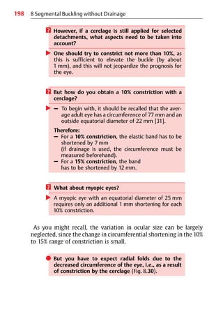198
? However, if a cerclage is still applied for selected
detachments, what aspects need to be taken into
account?
왘 One should try to constrict not more than 10%, as
this is sufficient to elevate the buckle (by about
1 mm), and this will not jeopardize the prognosis for
the eye.
? But how do you obtain a 10% constriction with a
cerclage?
왘 – To begin with, it should be recalled that the aver-
age adult eye has a circumference of 77 mm and an
outside equatorial diameter of 22 mm [31].
Therefore:
– For a 10% constriction, the elastic band has to be
shortened by 7 mm
(if drainage is used, the circumference must be
measured beforehand).
– For a 15% constriction, the band
has to be shortened by 12 mm.
? What about myopic eyes?
왘 A myopic eye with an equatorial diameter of 25 mm
requires only an additional 1 mm shortening for each
10% constriction.
As you might recall, the variation in ocular size can be largely
neglected, since the change in circumferential shortening in the 10%
to 15% range of constriction is small.
쎲 But you have to expect radial folds due to the
decreased circumference of the eye, i.e., as a result
of constriction by the cerclage (Fig. 8.30).
8 Segmental Buckling without Drainage
 