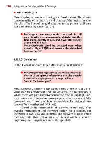 210
왘 Metamorphopsia
Metamorphopsia was tested using the Amsler chart. The distur-
bances manifested as distortion and blurring of the lines in the Am-
sler chart. The lines of the grid appeared to the patient “as if they
had been drawn by hand” [35, 36].
쎲 Postsurgical metamorphopsia occurred in all
patients with a previous macular detachment, this
time independently of age, and it was still present
at the end of 1 year.
Metamorphopsia could be detected even when
visual acuity of 20/20 and normal color vision had
been recovered.
8.12.1.2 Conclusions
Of the 4 visual functions tested after macular reattachment:
쎲 Metamorphopsia represented the most sensitive in-
dicator of an episode of previous macular detach-
ment. Metamorphopsia can be regarded as a
“scar in the Amsler grid.”
Metamorphopsia therefore represents a kind of memory of a pre-
vious macular detachment, and this was even true for patients in
whom there was partial involvement of the macula (Fig. 8.33)—i.e.,
there was a sector-shaped metamorphopsia in the presence of fully
recovered visual acuity without detectable color vision distur-
bances (Farnsworth panel d-15 test).
Visual acuity improved in all patients immediately after
macular reattachment and increased rapidly for 3 months, but
thereafter it was slow and minimal. The recovery of color vision
took place later than that of visual acuity and was less frequent,
only being found in patients under the age of 60.
8 Segmental Buckling without Drainage
 