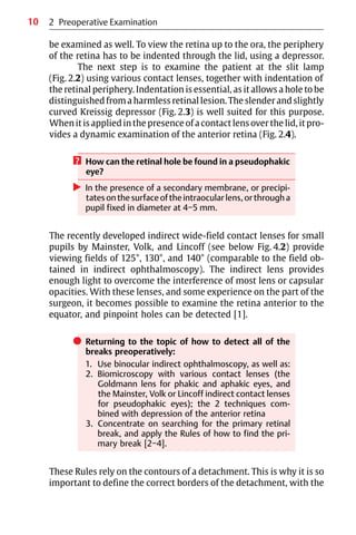 10
be examined as well. To view the retina up to the ora, the periphery
of the retina has to be indented through the lid, using a depressor.
The next step is to examine the patient at the slit lamp
(Fig. 2.2) using various contact lenses, together with indentation of
the retinal periphery. Indentation is essential, as it allows a hole to be
distinguished from a harmless retinal lesion. The slender and slightly
curved Kreissig depressor (Fig. 2.3) is well suited for this purpose.
When it is applied in the presence of a contact lens over the lid, it pro-
vides a dynamic examination of the anterior retina (Fig. 2.4).
? How can the retinal hole be found in a pseudophakic
eye?
왘 In the presence of a secondary membrane, or precipi-
tates on the surface of the intraocular lens, or through a
pupil fixed in diameter at 4−5 mm.
The recently developed indirect wide-field contact lenses for small
pupils by Mainster, Volk, and Lincoff (see below Fig. 4.2) provide
viewing fields of 125°, 130°, and 140° (comparable to the field ob-
tained in indirect ophthalmoscopy). The indirect lens provides
enough light to overcome the interference of most lens or capsular
opacities. With these lenses, and some experience on the part of the
surgeon, it becomes possible to examine the retina anterior to the
equator, and pinpoint holes can be detected [1].
쎲 Returning to the topic of how to detect all of the
breaks preoperatively:
1. Use binocular indirect ophthalmoscopy, as well as:
2. Biomicroscopy with various contact lenses (the
Goldmann lens for phakic and aphakic eyes, and
the Mainster, Volk or Lincoff indirect contact lenses
for pseudophakic eyes); the 2 techniques com-
bined with depression of the anterior retina
3. Concentrate on searching for the primary retinal
break, and apply the Rules of how to find the pri-
mary break [2−4].
These Rules rely on the contours of a detachment. This is why it is so
important to define the correct borders of the detachment, with the
2 Preoperative Examination
 