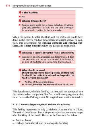 218 8 Segmental Buckling without Drainage
? Is this a failure?
왘 No.
? What is different here?
왘 Analyze once again the residual detachment with re-
gard to its contours, surfaces, and this time once again
its location in relation to the ora serrata.
When the patient lies flat, the fluid will not shift as it would have
done in the convex residual detachment discussed above. By con-
trast, this detachment has concave contours and concave sur-
faces, and it does not shift when the patient is positioned.
? What else is specific about this retinal detachment?
왘 In contrast to a rhegmatogenous detachment, it does
not extend to the ora serrata; instead, it is limited to
an area of starfolds with connecting traction lines.
? What should be done?
Should the patient be double patched and laid flat?
Or should the patient be advised to sleep with the
head elevated overnight?
왘 – Neither of these propositions.
– Instead, mobilize the patient without restrictions.
This detachment, which is fixed by traction, will not even pool into
the macula when the patient lies flat. It will slowly regress at the
same rate as the PVR regresses. No surgical intervention is needed.
8.13.1.3 Convex rhegmatogenous residual detachment
This finding represents an only partial reattachment due to failure.
The retinal detachment has postoperatively taken on a new shape
after buckling of the break. There can be 2 reasons for failure:
– Another break
– Leakage from a break due to inadequate buckling
 