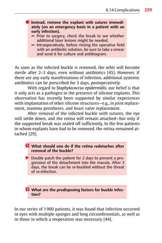 229
8.14 Complications
쎲 Instead, remove the explant with sutures immedi-
ately (on an emergency basis in a patient with an
early infection).
– Prior to surgery, check the break to see whether
additional laser lesions might be needed.
– Intraoperatively, before rinsing the operative field
with an antibiotic solution, be sure to take a smear
and send it for culture and antibiogram.
As soon as the infected buckle is removed, the orbit will become
sterile after 2−3 days, even without antibiotics [45]. However, if
there are any early manifestations of infection, additional systemic
antibiotics can be prescribed for 3 days, postoperatively.
With regard to Staphylococcus epidermidis, our belief is that
it only acts as a pathogen in the presence of silicone explants. This
observation has recently been supported by similar experiences
with implantation of other silicone structures—e.g., in joint replace-
ment, mamma prostheses, and heart valve replacement.
After removal of the infected buckle with sutures, the eye
will settle down, and the retina will remain attached—but only if
the supported break was sealed off sufficiently. In the few patients
in whom explants have had to be removed, the retina remained at-
tached [29].
? What should one do if the retina redetaches after
removal of the buckle?
왘 Double patch the patient for 2 days to prevent a pro-
gression of the detachment into the macula. After 3
days, the break can be re-buckled without the threat
of re-infection.
? What are the predisposing factors for buckle infec-
tion?
In our series of 1900 patients, it was found that infection occurred
in eyes with multiple sponges and long circumferentials, as well as
in those in which a reoperation was necessary [44].
 