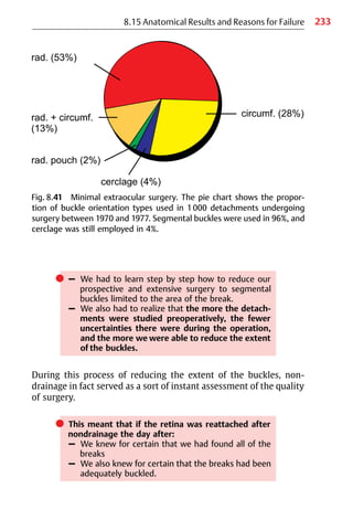 233
8.15 Anatomical Results and Reasons for Failure
Fig. 8.41 Minimal extraocular surgery. The pie chart shows the propor-
tion of buckle orientation types used in 1000 detachments undergoing
surgery between 1970 and 1977. Segmental buckles were used in 96%, and
cerclage was still employed in 4%.
쎲 – We had to learn step by step how to reduce our
prospective and extensive surgery to segmental
buckles limited to the area of the break.
– We also had to realize that the more the detach-
ments were studied preoperatively, the fewer
uncertainties there were during the operation,
and the more we were able to reduce the extent
of the buckles.
During this process of reducing the extent of the buckles, non-
drainage in fact served as a sort of instant assessment of the quality
of surgery.
쎲 This meant that if the retina was reattached after
nondrainage the day after:
– We knew for certain that we had found all of the
breaks
– We also knew for certain that the breaks had been
adequately buckled.
 