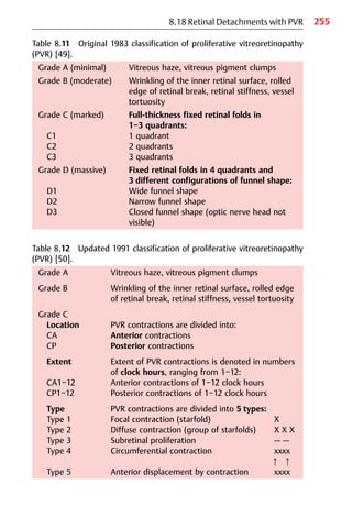 255
Table 8.11 Original 1983 classification of proliferative vitreoretinopathy
(PVR) [49].
Grade A (minimal) Vitreous haze, vitreous pigment clumps
Grade B (moderate) Wrinkling of the inner retinal surface, rolled
edge of retinal break, retinal stiffness, vessel
tortuosity
Grade C (marked) Full-thickness fixed retinal folds in
1−3 quadrants:
C1 1 quadrant
C2 2 quadrants
C3 3 quadrants
Grade D (massive) Fixed retinal folds in 4 quadrants and
3 different configurations of funnel shape:
D1 Wide funnel shape
D2 Narrow funnel shape
D3 Closed funnel shape (optic nerve head not
visible)
8.18 Retinal Detachments with PVR
Table 8.12 Updated 1991 classification of proliferative vitreoretinopathy
(PVR) [50].
Grade A Vitreous haze, vitreous pigment clumps
Grade B Wrinkling of the inner retinal surface, rolled edge
of retinal break, retinal stiffness, vessel tortuosity
Grade C
Location PVR contractions are divided into:
CA Anterior contractions
CP Posterior contractions
Extent Extent of PVR contractions is denoted in numbers
of clock hours, ranging from 1−12:
CA1−12 Anterior contractions of 1−12 clock hours
CP1−12 Posterior contractions of 1−12 clock hours
Type PVR contractions are divided into 5 types:
Type 1 Focal contraction (starfold) X
Type 2 Diffuse contraction (group of starfolds) X X X
Type 3 Subretinal proliferation — —
Type 4 Circumferential contraction xxxx
앖 앖
Type 5 Anterior displacement by contraction xxxx
 