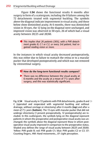 272 8 Segmental Buckling without Drainage
Figure 8.54 shows the functional results 6 months after
surgery in form of a scattergram, including the 8 failures among the
72 detachments treated with segmental buckling. The symbols
above the diagonal indicate improvement in visual acuity, and those
below show diminished acuity. At 6 months, there was diminished
vision in 10 eyes, the 12 lying on the diagonal were unchanged, and
improved vision was observed in 50 eyes, 26 of which had a visual
acuity between 20/25 and 20/60.
쎲 This implies that 26 patients (36%), with a PVR detach-
ment grades B, C1 or C2, or every 3rd patient, had re-
gained reading vision or more.
In the instances in which visual acuity decreased postoperatively,
this was either due to failure to reattach the retina or to a macular
pucker that developed postoperatively and which was not removed
by vitreoretinal surgery.
? How do the long-term functional results compare?
왘 There was no difference between the visual acuity at
6 months and the acuity at a mean of 71/2 years after
surgery, and this was statistically significant.
Fig. 8.54 Visual acuity in 72 patients with PVR detachments, grades B and 컄
C (operated and reoperated with segmental buckling and without
drainage, without cerclage or vitrectomy) after 6 months (top) and after a
mean of 71/2 years (bottom). The 13 eyes with macular pucker that did not
undergo vitrectomy (1 present preoperatively, 12 postoperatively) are in-
cluded. In this scattergram, the symbols lying on the diagonal represent
patients in whom the preoperative and postoperative visual acuity was un-
changed; the symbols above the diagonal represent those in whom post-
operative visual acuity improved in comparison to the preoperative status.
Shaded area defines the range of visual acuity between 20/25 and 20/60.
Yellow: PVR grade B; red: PVR grade C1; blue: PVR grades C2 or C3. CF:
Counting fingers, HM: Hand movements., LP: Light perception.
 