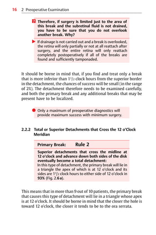 16 2 Preoperative Examination
? Therefore, if surgery is limited just to the area of
this break and the subretinal fluid is not drained,
you have to be sure that you do not overlook
another break. Why?
왘 If drainage is not carried out and a break is overlooked,
the retina will only partially or not at all reattach after
surgery, and the entire retina will only reattach
completely postoperatively if all of the breaks are
found and sufficiently tamponaded.
It should be borne in mind that, if you find and treat only a break
that is more inferior than 11/2 clock hours from the superior border
in the detachment, the chances of success will be small (in the range
of 2%). The detachment therefore needs to be examined carefully,
and both the primary break and any additional breaks that may be
present have to be localized.
쎲 Only a maximum of preoperative diagnostics will
provide maximum success with minimum surgery.
2.2.2 Total or Superior Detachments that Cross the 12 o’Clock
Meridian
Primary Break: Rule 2
Superior detachments that cross the midline at
12 o’clock and advance down both sides of the disk
eventually become a total detachment:
In this type of detachment, the primary break will lie in
a triangle the apex of which is at 12 o’clock and its
sides are 11/2 clock hours to either side of 12 o’clock in
93% (Fig. 2.6a).
This means that in more than 9 out of 10 patients, the primary break
that causes this type of detachment will lie in a triangle whose apex
is at 12 o’clock. It should be borne in mind that the closer the hole is
toward 12 o’clock, the closer it tends to be to the ora serrata.
 