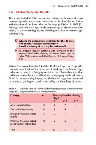 37
3.4 Clinical Study and Results
3.4 Clinical Study and Results
The study included 100 consecutive patients with acute vitreous
hemorrhage who underwent treatment with binocular occlusion
and elevation of the head; the results were published in 1977 [3].
Among them were 43 eyes with hemorrhage of rhegmatogenous
origin; in the remaining 57, the bleeding was due to hemorrhagic
vasculopathy.
? What is the appropriate treatment for the 43 eyes
with rhegmatogenous hemorrhage?
Should a primary vitrectomy be performed?
왘 No. Instead, double patching with elevation of the
patient’s head led to clearing in 38 eyes: 20 of them in
1 day, 15 by 4 days, and 3 by the end of 1 week (Table
3.1).
Retinal tears were found in 25 of the 38 cleared eyes, in 16 eyes the
tear was combined with a detachment. In 4 eyes, the hemorrhage
had occurred due to a bridging vessel across a horseshoe tear that
had been treated by a scleral buckle and cryopexy. No breaks were
found in the remaining 9 eyes, and the hemorrhage was presumed
to be due to pulling on a retinal vessel by the detaching vitreous.
Table 3.1 Clearing time in 38 eyes with rhegmatogenous vitreous hemor-
rhage that responded to ocular immobilization.
Etiology n Time required for clearing
(days)
1 2−4 5−7
Attached retinal tears 9 7 2 –
Tears with detachment 16 9 6 1
Bridging vessel on scleral
buckle
4 2 1 1
Posterior hyaloidal detach-
ment without retinal tear
9 2 6 1
Total 38 20 15 3
 