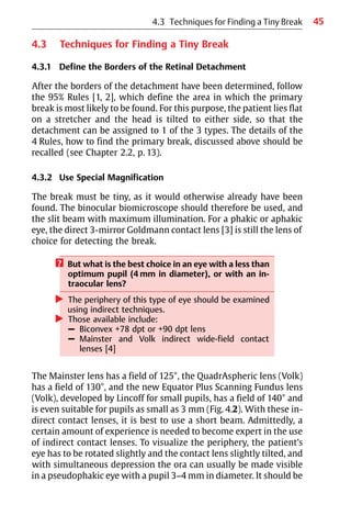 45
4.3 Techniques for Finding a Tiny Break
4.3.1 Define the Borders of the Retinal Detachment
After the borders of the detachment have been determined, follow
the 95% Rules [1, 2], which define the area in which the primary
break is most likely to be found. For this purpose, the patient lies flat
on a stretcher and the head is tilted to either side, so that the
detachment can be assigned to 1 of the 3 types. The details of the
4 Rules, how to find the primary break, discussed above should be
recalled (see Chapter 2.2, p. 13).
4.3.2 Use Special Magnification
The break must be tiny, as it would otherwise already have been
found. The binocular biomicroscope should therefore be used, and
the slit beam with maximum illumination. For a phakic or aphakic
eye, the direct 3-mirror Goldmann contact lens [3] is still the lens of
choice for detecting the break.
? But what is the best choice in an eye with a less than
optimum pupil (4 mm in diameter), or with an in-
traocular lens?
왘 The periphery of this type of eye should be examined
using indirect techniques.
왘 Those available include:
– Biconvex +78 dpt or +90 dpt lens
– Mainster and Volk indirect wide-field contact
lenses [4]
The Mainster lens has a field of 125°, the QuadrAspheric lens (Volk)
has a field of 130°, and the new Equator Plus Scanning Fundus lens
(Volk), developed by Lincoff for small pupils, has a field of 140° and
is even suitable for pupils as small as 3 mm (Fig. 4.2). With these in-
direct contact lenses, it is best to use a short beam. Admittedly, a
certain amount of experience is needed to become expert in the use
of indirect contact lenses. To visualize the periphery, the patient’s
eye has to be rotated slightly and the contact lens slightly tilted, and
with simultaneous depression the ora can usually be made visible
in a pseudophakic eye with a pupil 3−4 mm in diameter. It should be
4.3 Techniques for Finding a Tiny Break
 