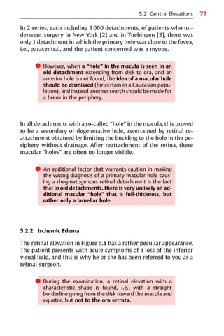 73
In 2 series, each including 1000 detachments, of patients who un-
derwent surgery in New York [2] and in Tuebingen [3], there was
only 1 detachment in which the primary hole was close to the fovea,
i.e., paracentral, and the patient concerned was a myope.
쎲 However, when a “hole” in the macula is seen in an
old detachment extending from disk to ora, and an
anterior hole is not found, the idea of a macular hole
should be dismissed (for certain in a Caucasian popu-
lation), and instead another search should be made for
a break in the periphery.
In all detachments with a so-called “hole” in the macula, this proved
to be a secondary or degenerative hole, ascertained by retinal re-
attachment obtained by limiting the buckling to the hole in the pe-
riphery without drainage. After reattachment of the retina, these
macular “holes” are often no longer visible.
쎲 An additional factor that warrants caution in making
the wrong diagnosis of a primary macular hole caus-
ing a rhegmatogenous retinal detachment is the fact
that in old detachments, there is very unlikely an ad-
ditional macular “hole” that is full-thickness, but
rather only a lamellar hole.
5.2.2 Ischemic Edema
The retinal elevation in Figure 5.5 has a rather peculiar appearance.
The patient presents with acute symptoms of a loss of the inferior
visual field, and this is why he or she has been referred to you as a
retinal surgeon.
쎲 During the examination, a retinal elevation with a
characteristic shape is found, i.e., with a straight
borderline going from the disk toward the macula and
equator, but not to the ora serrata.
5.2 Central Elevations
 