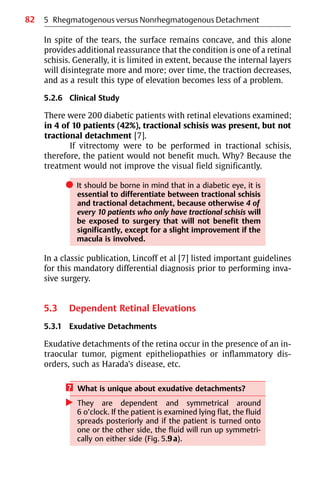 82 5 Rhegmatogenous versus Nonrhegmatogenous Detachment
In spite of the tears, the surface remains concave, and this alone
provides additional reassurance that the condition is one of a retinal
schisis. Generally, it is limited in extent, because the internal layers
will disintegrate more and more; over time, the traction decreases,
and as a result this type of elevation becomes less of a problem.
5.2.6 Clinical Study
There were 200 diabetic patients with retinal elevations examined;
in 4 of 10 patients (42%), tractional schisis was present, but not
tractional detachment [7].
If vitrectomy were to be performed in tractional schisis,
therefore, the patient would not benefit much. Why? Because the
treatment would not improve the visual field significantly.
쎲 It should be borne in mind that in a diabetic eye, it is
essential to differentiate between tractional schisis
and tractional detachment, because otherwise 4 of
every 10 patients who only have tractional schisis will
be exposed to surgery that will not benefit them
significantly, except for a slight improvement if the
macula is involved.
In a classic publication, Lincoff et al [7] listed important guidelines
for this mandatory differential diagnosis prior to performing inva-
sive surgery.
5.3 Dependent Retinal Elevations
5.3.1 Exudative Detachments
Exudative detachments of the retina occur in the presence of an in-
traocular tumor, pigment epitheliopathies or inflammatory dis-
orders, such as Harada’s disease, etc.
? What is unique about exudative detachments?
왘 They are dependent and symmetrical around
6 o’clock. If the patient is examined lying flat, the fluid
spreads posteriorly and if the patient is turned onto
one or the other side, the fluid will run up symmetri-
cally on either side (Fig. 5.9a).
 