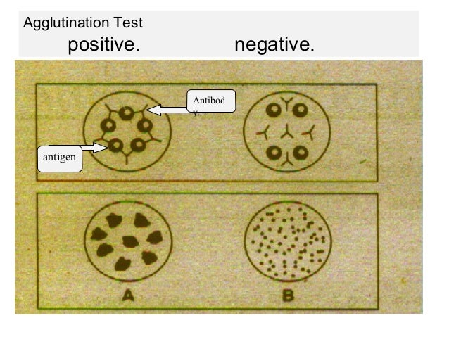 improving the safety and quality of eggs and egg products volume 1 egg chemistry production and consumption food science technology and nutrition