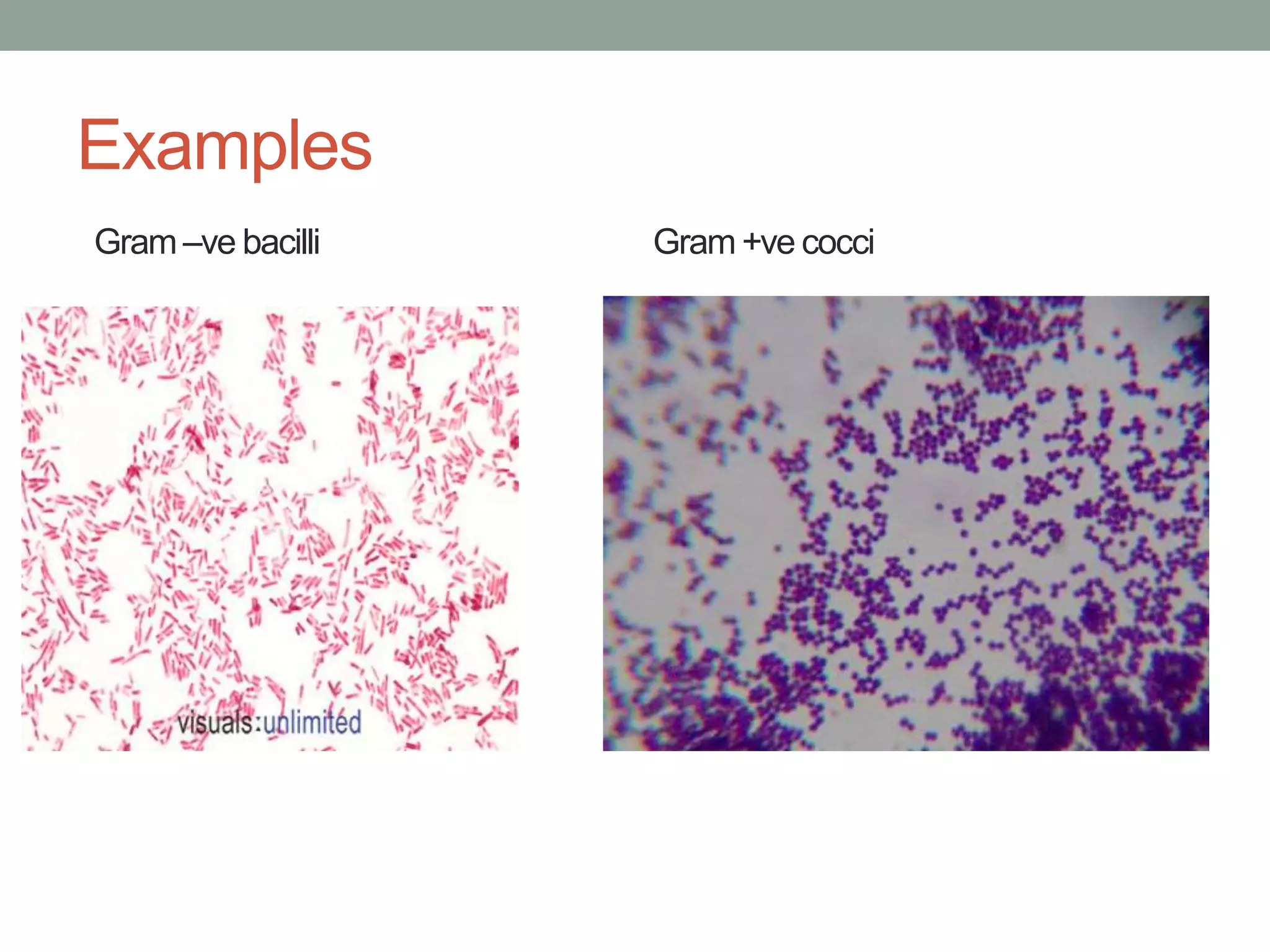 Examples
Gram –ve bacilli Gram +ve cocci