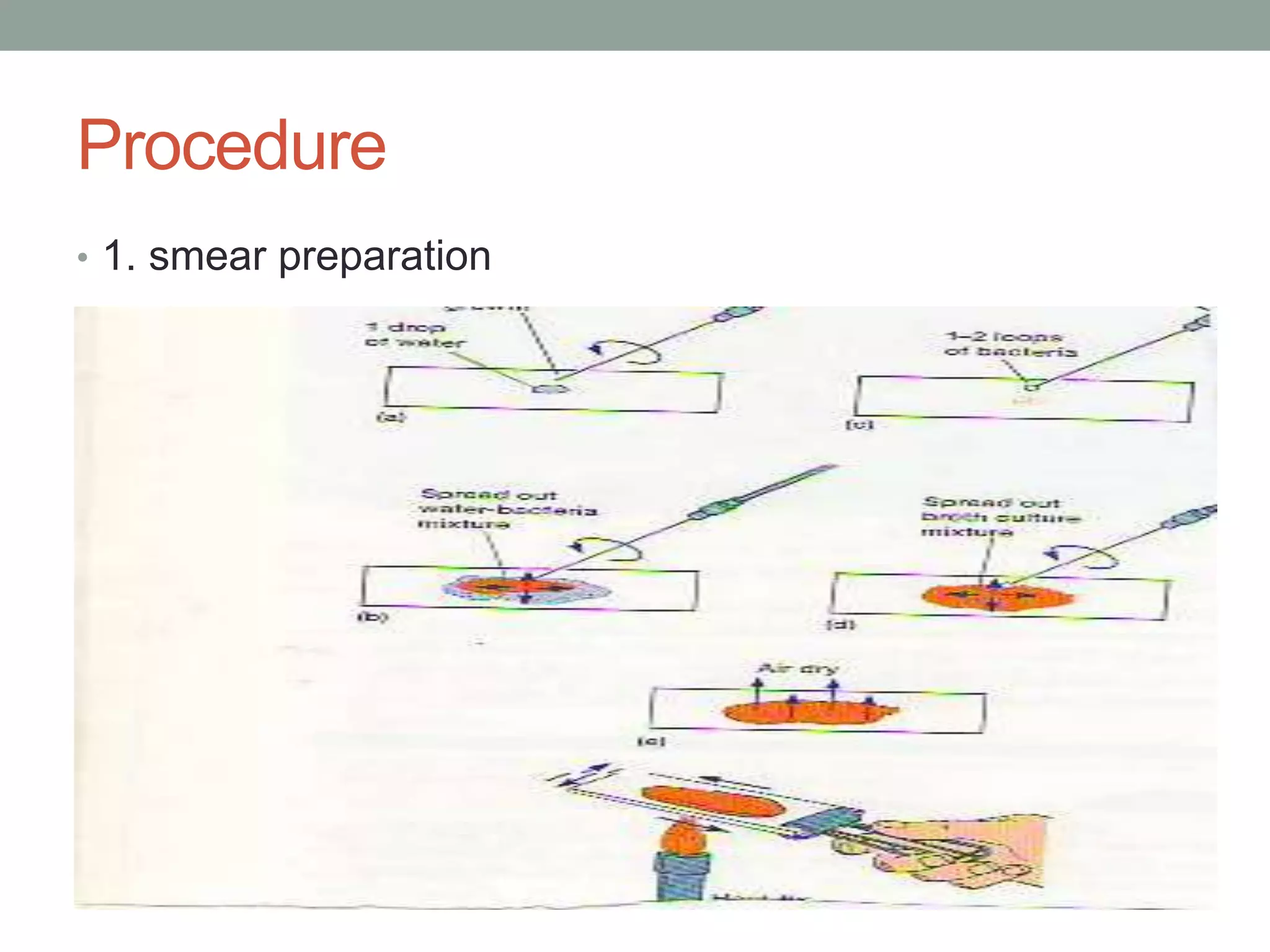 • 1. smear preparation
Procedure