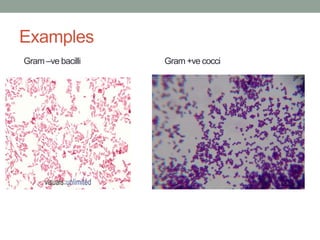 Examples
Gram –ve bacilli Gram +ve cocci
 